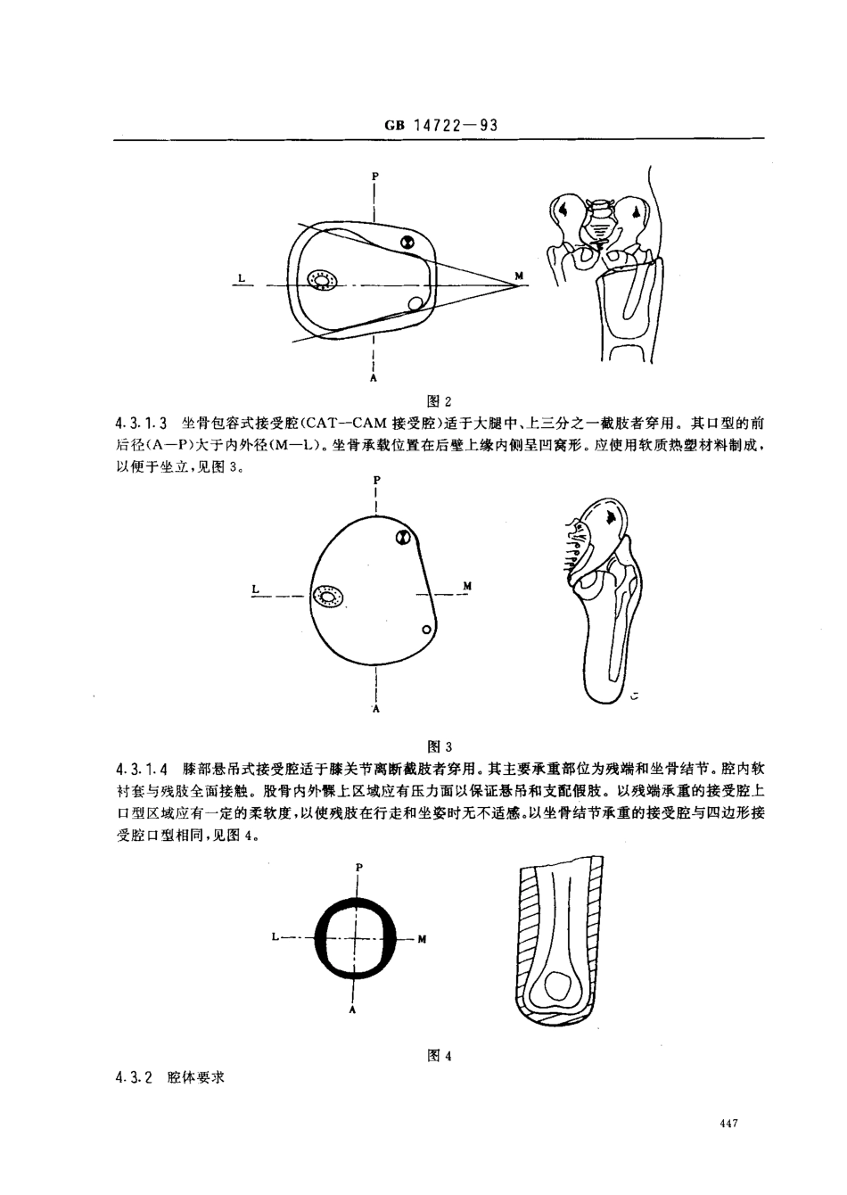 GB 14722-1993 骨骼式大腿假肢.pdf_第3页