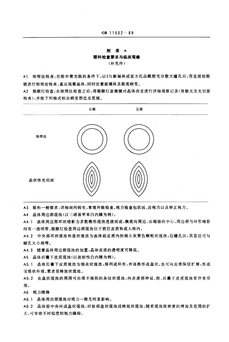 GB 11502-1989 职业性白内障诊断标准及处理原则.pdf_第3页