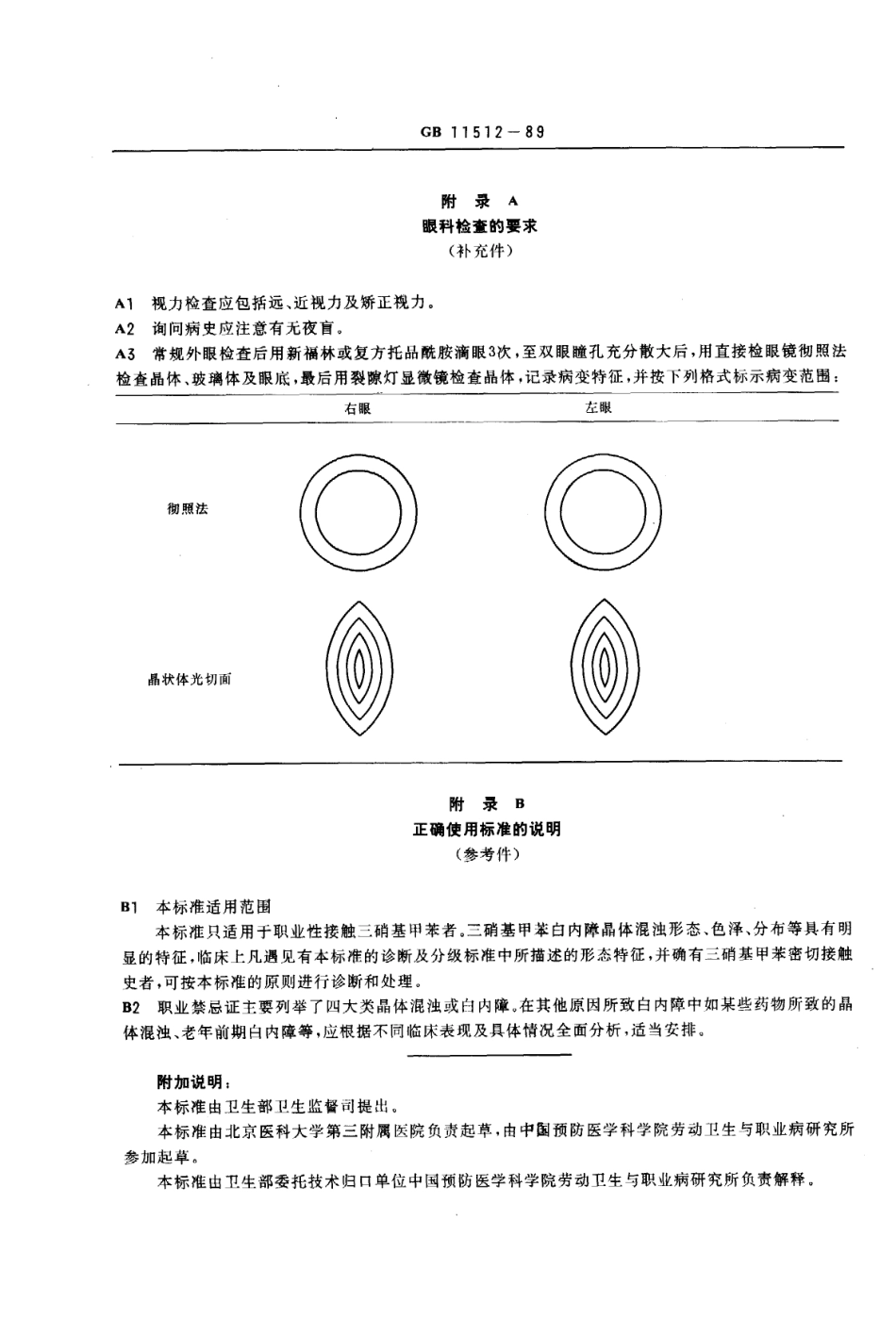 GB 11512-1989 职业性三硝基甲苯白内障诊断标准及处理原则.pdf_第3页
